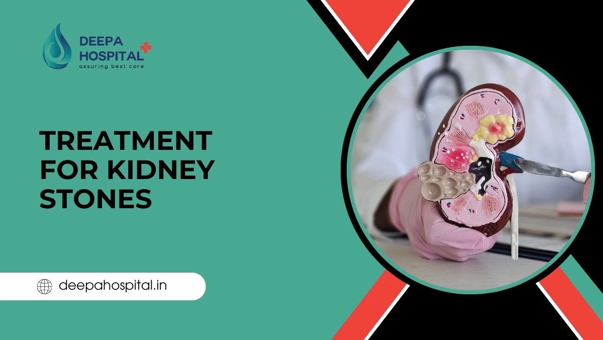 Treatment for Kidney Stones