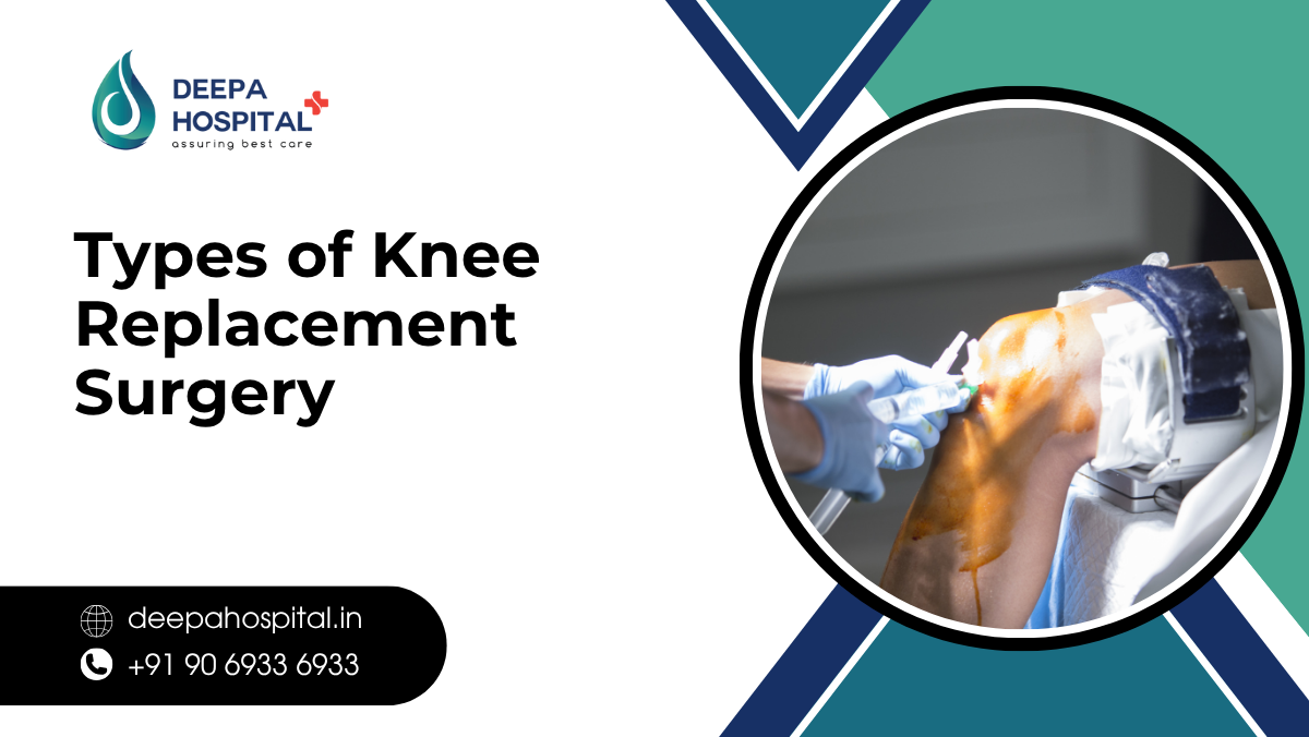 Types of Knee Replacement Surgery