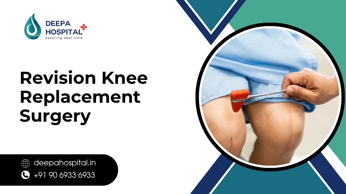 Revision Knee Replacement Surgery