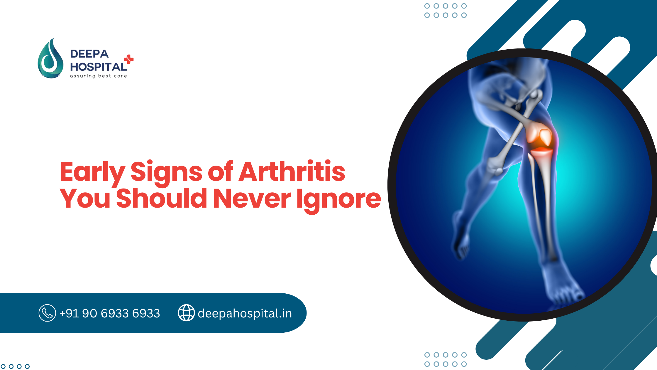 Early Signs of Arthritis You Should Never Ignore
