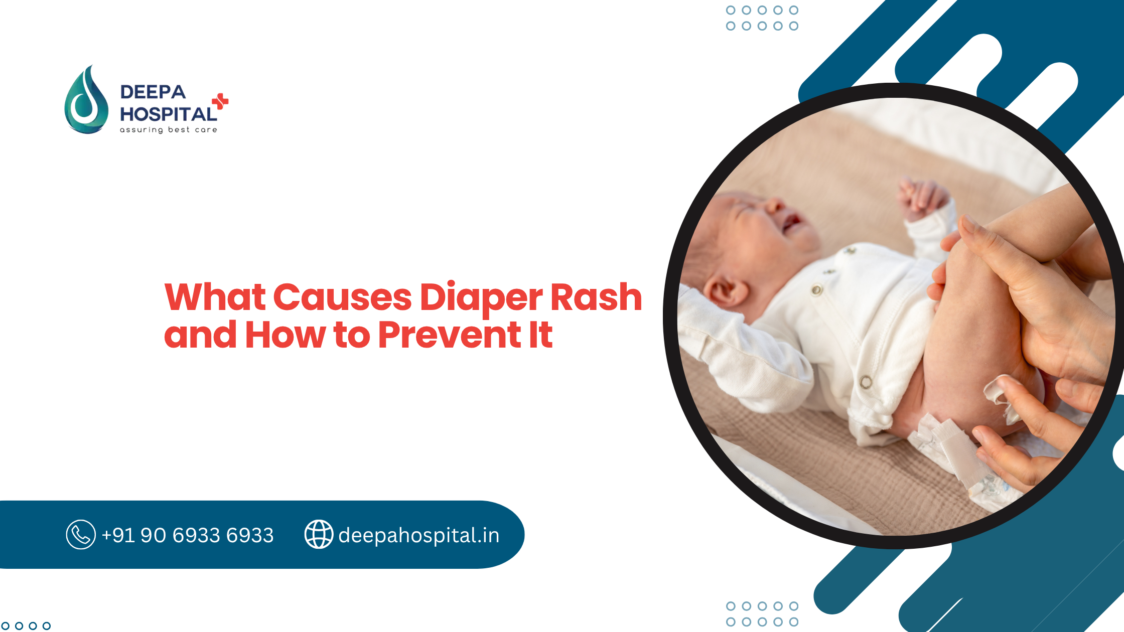 What Causes Diaper Rash and How to Prevent It